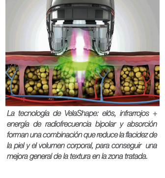 La tecnología del VelaShape III