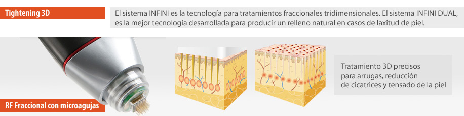 Tightening 3D